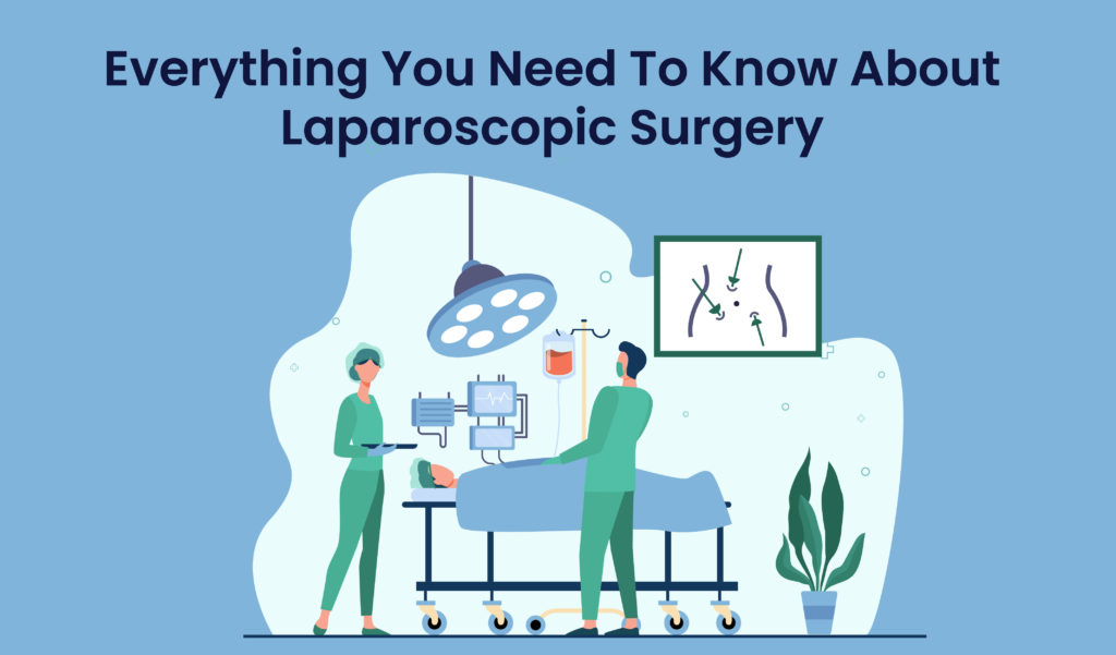 Everything you need to know about laparoscopic surgery